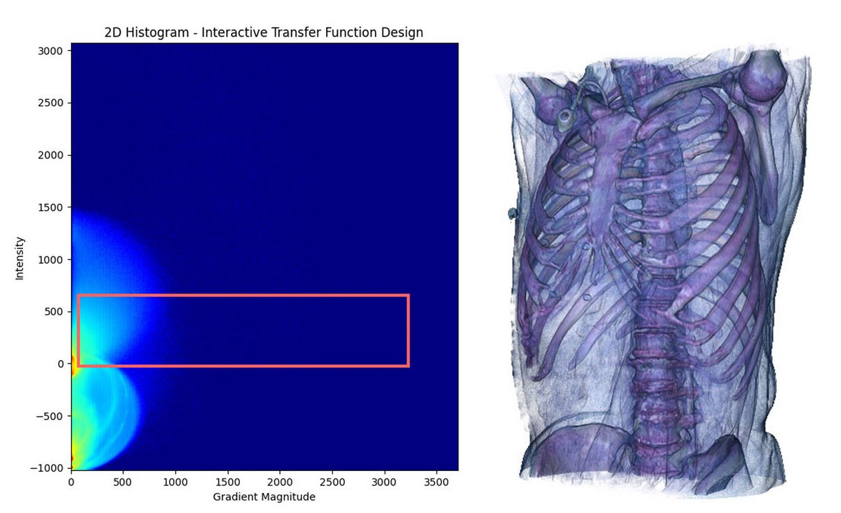interactive 2D transfer function editor