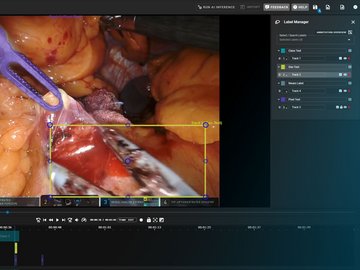ImViA goes live